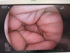 Video Transnasal Gastroscope｜EG-580NW2｜Fujifilm Medical photo7