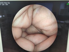 上部消化管用経鼻スコープ｜EG-3000N｜富士フイルムメディカルの写真7枚目