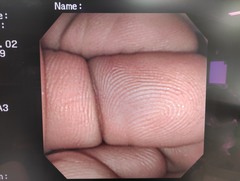 Video Duodenoscope｜JF-240｜Olympus Medical Systems photo7