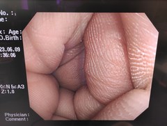 大腸ビデオスコープ｜PCF-Q260AZI｜オリンパスメディカルシステムズ株式会社の写真7枚目