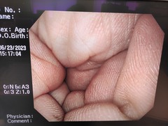 上部消化管汎用ビデオスコープ｜GIF-PQ260｜オリンパスメディカルシステムズ株式会社の写真7枚目