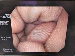上部消化管汎用ビデオスコープ｜GIF-Q260｜オリンパスメディカルシステムズ株式会社の写真7枚目
