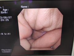 上部消化管汎用ビデオスコープ｜GIF-XQ240｜オリンパスメディカルシステムズ株式会社の写真7枚目