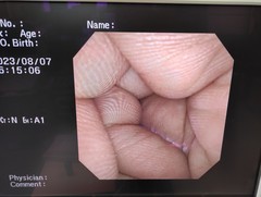 Video Transnasal Gastroscope｜GIF-XP260N｜Olympus Medical Systems photo7