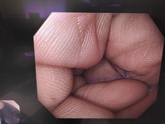 大腸ビデオスコープ｜CF-H290I｜オリンパスメディカルシステムズ株式会社の写真7枚目