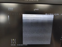 Ultrasound system｜ARIETTA 60｜Hitachi photo7