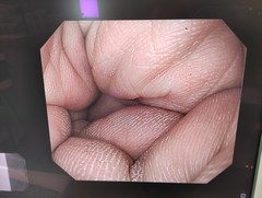 上部消化管汎用ビデオスコープ｜GIF-Q260｜オリンパスメディカルシステムズ株式会社の写真7枚目