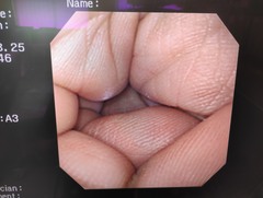 上部消化管汎用ビデオスコープ｜GIF-XQ240｜オリンパスメディカルシステムズ株式会社の写真7枚目