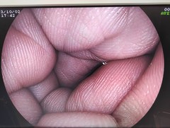 上部消化管スコープ｜EG-3000WR｜富士フイルムメディカルの写真7枚目