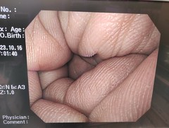 上部消化管汎用ビデオスコープ｜GIF-Q240X｜オリンパスメディカルシステムズ株式会社の写真7枚目