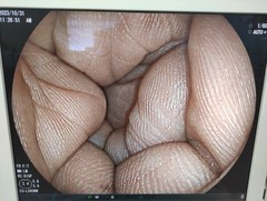 Video Transnasal Gastroscope｜EG-L580NW｜Fujifilm Medical photo7