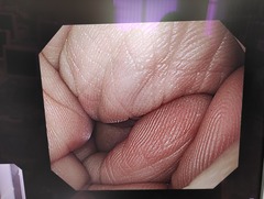 上部消化管汎用ビデオスコープ｜GIF-Q260｜オリンパスメディカルシステムズ株式会社の写真7枚目