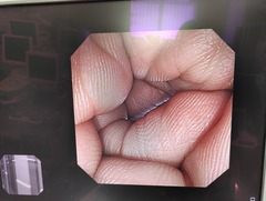 Video Colonoscope｜CF-240I｜Olympus Medical Systems photo7