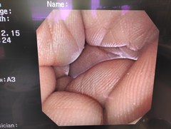 Video Gastroscope｜GIF-XP260NS｜Olympus Medical Systems photo7