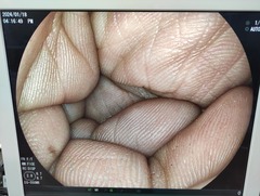上部消化管細経スコープ｜EG-550WR｜富士フイルムメディカルの写真7枚目