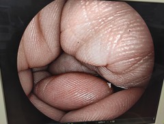 Video Colonoscope｜EC-590MP｜Fujifilm Medical photo7