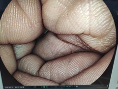 Video Gastroscope｜EG-450WR5｜Fujifilm Medical photo7