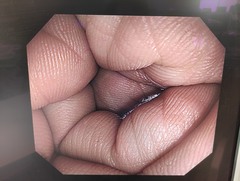 上部消化管汎用ビデオスコープ｜GIF-HQ290｜オリンパスメディカルシステムズ株式会社の写真7枚目