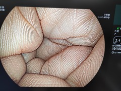 上部消化管用経鼻スコープ｜EG-L580NW7｜富士フイルムメディカルの写真7枚目