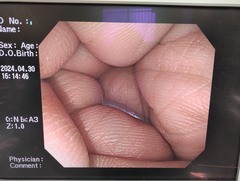 大腸ビデオスコープ｜PCF-Q260AI｜オリンパスメディカルシステムズ株式会社の写真7枚目