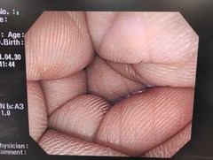 大腸ビデオスコープ｜PCF-Q260AI｜オリンパスメディカルシステムズ株式会社の写真7枚目