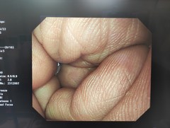 上部消化管汎用ビデオスコープ｜GIF-H290｜オリンパスメディカルシステムズ株式会社の写真7枚目