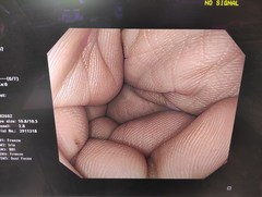 Video Gastroscope｜GIF-H260Z｜Olympus Medical Systems photo7