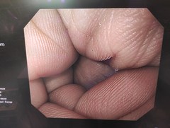 上部消化管汎用ビデオスコープ｜GIF-Q240｜オリンパスメディカルシステムズ株式会社の写真7枚目