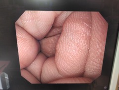 上部消化管汎用ビデオスコープ｜GIF-H290｜オリンパスメディカルシステムズ株式会社の写真7枚目