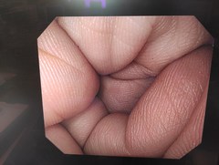 上部消化管汎用ビデオスコープ｜GIF-H290｜オリンパスメディカルシステムズ株式会社の写真7枚目