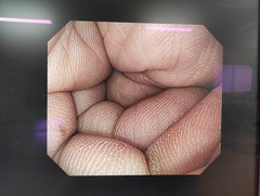 上部消化管汎用ビデオスコープ｜GIF-H290｜オリンパスメディカルシステムズ株式会社の写真7枚目