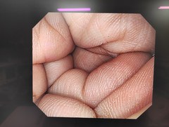 上部消化管汎用ビデオスコープ｜GIF-Q260｜オリンパスメディカルシステムズ株式会社の写真7枚目
