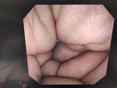 上部消化管汎用ビデオスコープ(径鼻対応)｜GIF-XP260N｜オリンパスメディカルシステムズ株式会社の写真7枚目