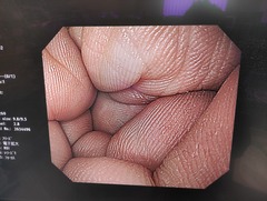 上部消化管汎用ビデオスコープ｜GIF-H260｜オリンパスメディカルシステムズ株式会社の写真7枚目