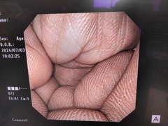 上部消化管経鼻スコープ｜GIF-XP170N｜オリンパスメディカルシステムズ株式会社の写真7枚目