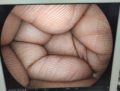 上部消化管用経鼻スコープ｜EG-530NW｜富士フイルムメディカルの写真7枚目
