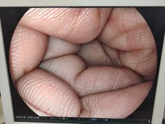 上部消化管細経スコープ｜EG-550WR｜富士フイルムメディカルの写真7枚目