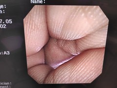 上部消化管汎用ビデオスコープ(径鼻対応)｜GIF-XP260N｜オリンパスメディカルシステムズ株式会社の写真7枚目