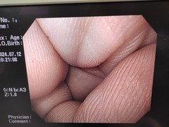 上部消化管汎用ビデオスコープ｜GIF-Q240X｜オリンパスメディカルシステムズ株式会社の写真7枚目