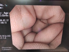 大腸ビデオスコープ｜CF-Q260AI｜オリンパスメディカルシステムズ株式会社の写真7枚目