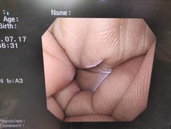 上部消化管汎用ビデオスコープ｜GIF-XQ240｜オリンパスメディカルシステムズ株式会社の写真7枚目