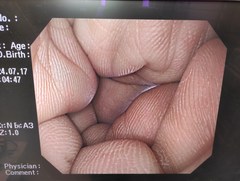 上部消化管汎用ビデオスコープ｜GIF-Q260｜オリンパスメディカルシステムズ株式会社の写真7枚目