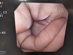 上部消化管汎用ビデオスコープ｜GIF-XQ260｜オリンパスメディカルシステムズ株式会社の写真7枚目