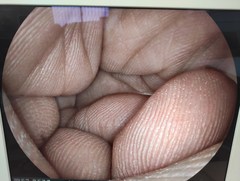 上部消化管用経鼻スコープ｜EG-580NW2｜富士フイルムメディカルの写真7枚目