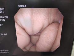 上部消化管汎用ビデオスコープ｜GIF-XP260NS｜オリンパスメディカルシステムズ株式会社の写真7枚目