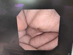 上部消化管汎用ビデオスコープ(径鼻)｜GIF-XP150N｜オリンパスメディカルシステムズ株式会社の写真7枚目
