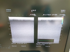 超音波診断装置（カラードプラ）｜ARIETTA 70｜日立製作所の写真7枚目