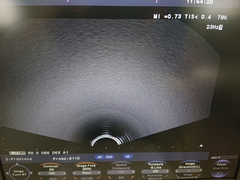 超音波診断装置｜F37｜日立製作所の写真7枚目