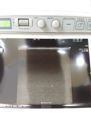 超音波診断装置｜F37｜日立製作所の写真7枚目