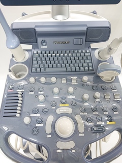 4D超音波診断装置（カラードプラ）｜Voluson P8｜GEヘルスケアの写真7枚目